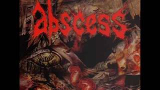 Watch Abscess Tormented video