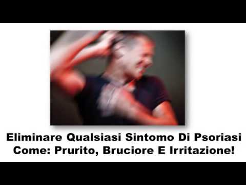 Calcio di cloruro a neurodermatitis
