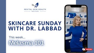 Skincare Sunday | Melasma 101