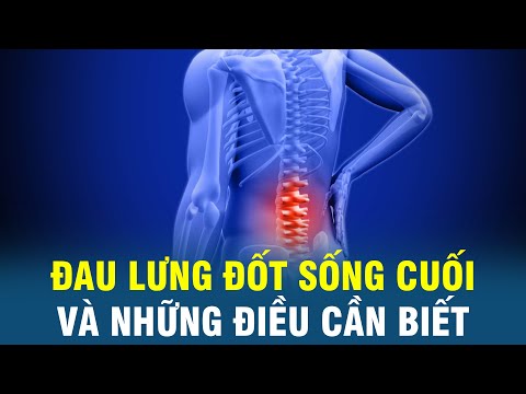 Phương pháp điều trị bệnh đau lưng ở đốt sống cuối - Zbone