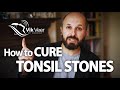 How to Cure Tonsil Stones