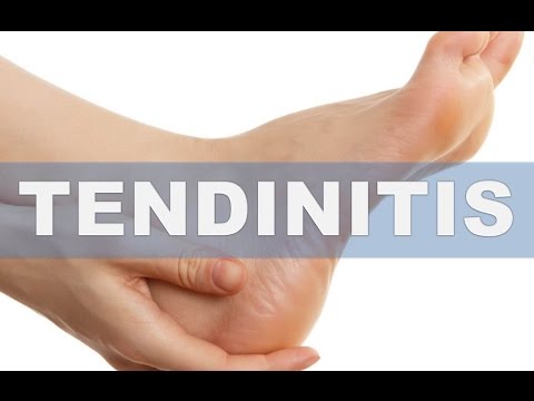 Los síntomas del hongo sobre las uñas de las manos