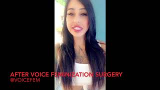 Before & After Voice Feminization Surgery