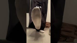 Dirty Sock Challenge 6