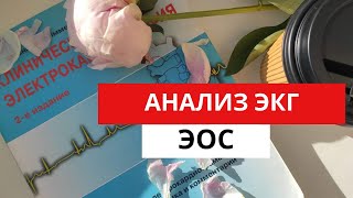 Анализ Экг. Определение  Эос- Электрической Оси Сердца. (Для Студентов)