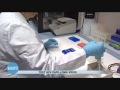 Nuovo test papilloma virus Nuovo test papilloma virus