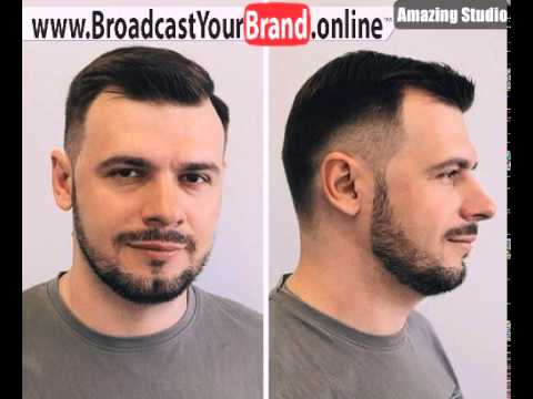 Какую прическу сделать девушке с залысинами Какую прическу сделать девушке с залысинами