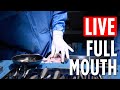 LIVE ALL-ON-X surgical procedure! Fully-Guided Full Mouth Reconstruction Over-The-Shoulder
