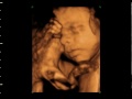 ultrasound 3d 4d