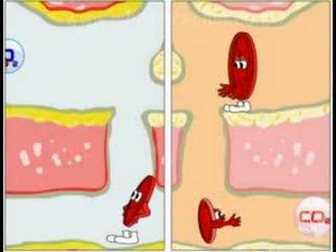 This is a 2D animated documentary on blood health. This video introduces us to three different components of blood ie RBCs, WBCs and Platelets,