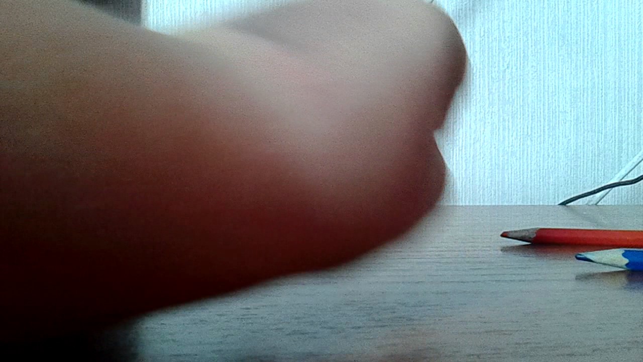 Как сделать гематому себе Как сделать гематому себе