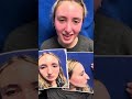 Septorhinoplasty/Sinus Surgery 4 months ago and looking great and breathing well