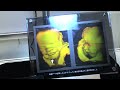 ultrasound 3d 4d
