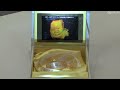 ultrasound 3d 4d