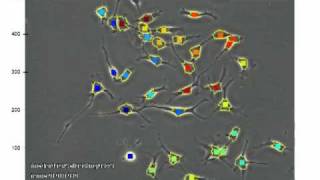 automatic cell tracking (phase contrast microscopy)