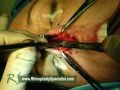 Videos 1 Videos