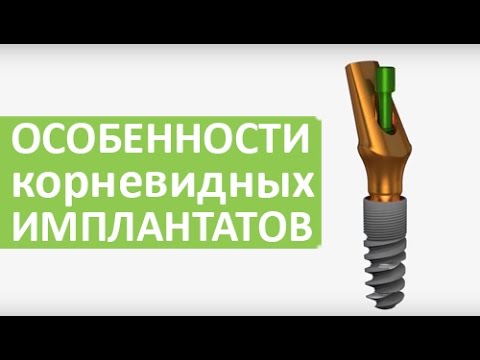 Rootform implants. Open implant system Rootform implants. Open implant system