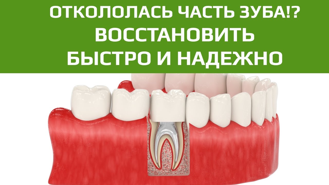 Отломалась часть зуба История завоевания Кавказа Arzamas