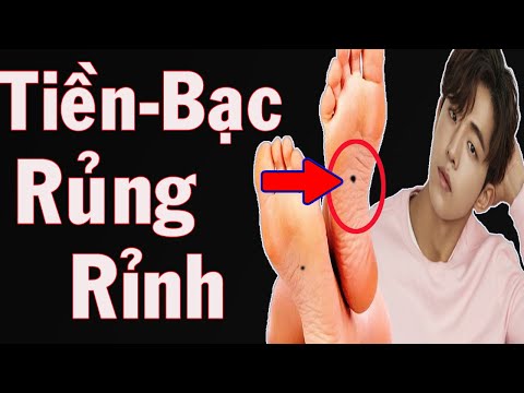 Dấu Hiệu Rủng Rỉnh Tiền Bạc Cả Đời Sung Sướng Khi Có Những Nốt Ruồi Phú Quý Này ở Bàn Chân