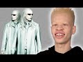 People With Albinism Review Albino Characters From Film