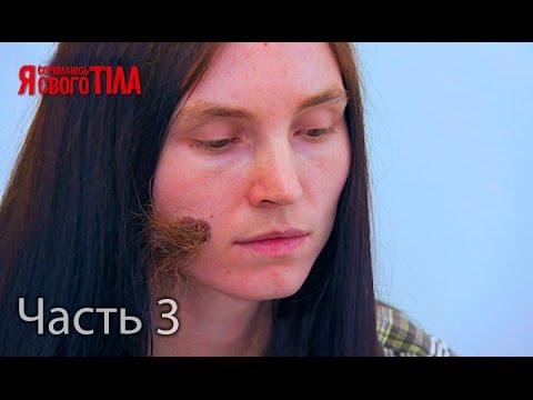 Девочка с большой рукой я стесняюсь своего тела 44