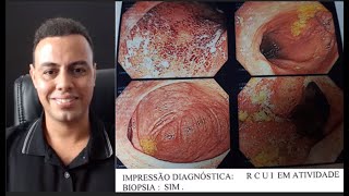 Private video