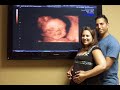 ultrasound 3d 4d