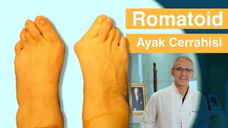 Romatoid Ayak Cerrahisi - Ameliyathane Anlatım Op. Dr. Selim Muğrabi