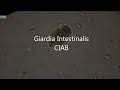 Giardia Lamblia CIAB  www.ciab.es
