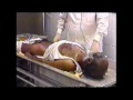 Arterial embalming for teaching purposes 1 of 2