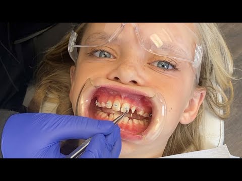 I had a Crazy Dream I got Braces! Jazzy Skye