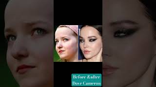 Dove Camerons Face Transformation Through The Years