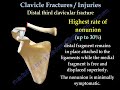 clavicular