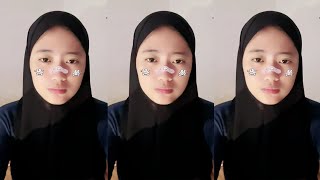 Derra Bigo Live Video Bigo4Fun2