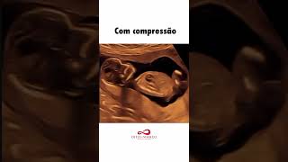 Aquela Grávida Que Gosta De Usar Roupa Apertada Na Gestação