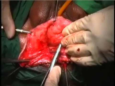 Clitoris Less Cunt - Experimental Fauna Clitoris Less Cunt - Experimental Fauna