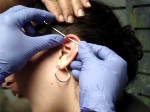 Me getting my industrial piercing done, was in March 17 in Ilussions Tattoo :]! It reaaally didn't hurt only the second one! Category: Howto & Style