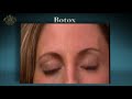 Orlando Botox Dr. Brian Joseph