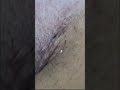 Ingrown hair removal after shaving after 2 years