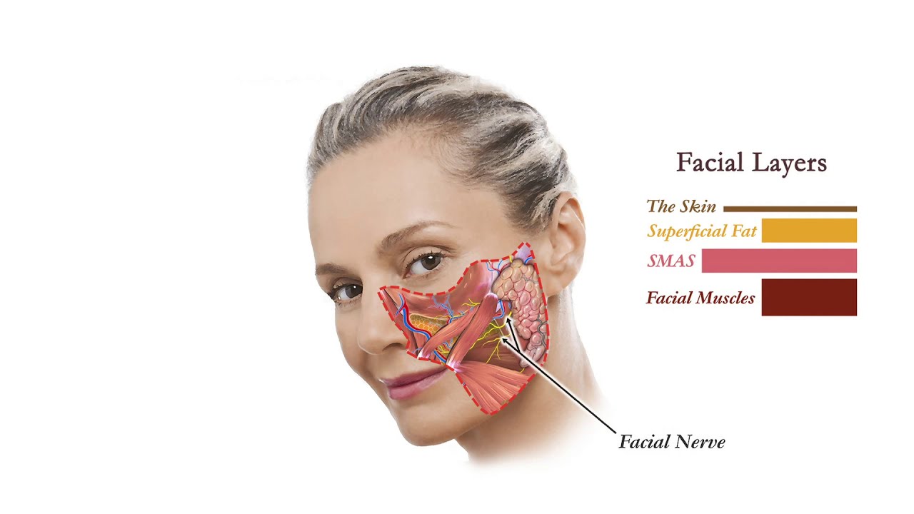 Avoiding danger facial facial in injury nerve plastic surgery zone