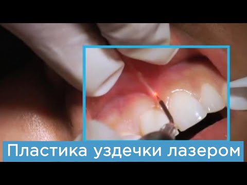 Можно ли красить брови краской для волос в домашних условиях? Мастер-класс: шьем детские краги Шкатулка