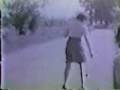 Peg Legged Woman