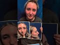 Septorhinoplasty/Sinus Surgery 4 months ago and looking great and breathing well