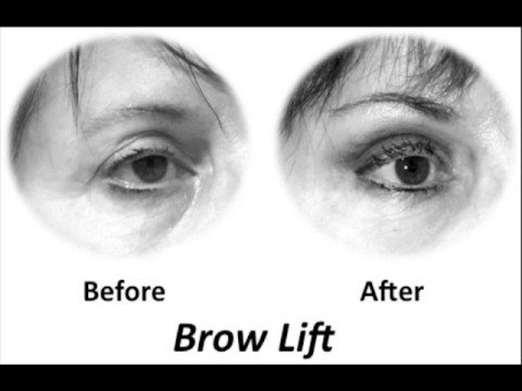 Before & After movie. Before & After movie Before & After movie. Before & After movie