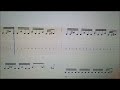 毒盛る 譜面~上手ギターver.~/R指定
