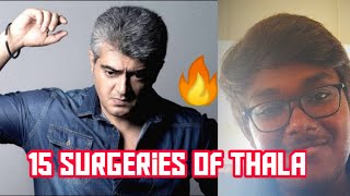 15 Surgeries Of Thala Ajith Tamil The Medical Stupid