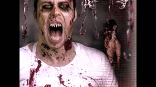 Watch Avulsed Devourer Of The Dead video