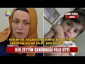 Bir zeytin çekirdeği felç etti Bir zeytin çekirdeği felç etti