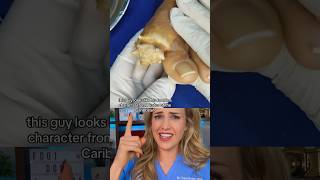 Doctor Explains Mysterious Foot Growth