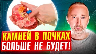 Главная Причина Камней В Почках: Как Их Растворить За 4 Шага?